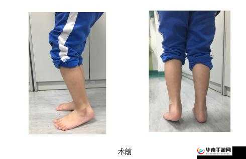 宝宝双腿交叉使劲用力:正常现象还是异常表现?