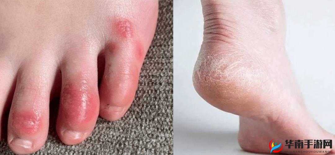 淑娟两腿间痒难耐引发关注