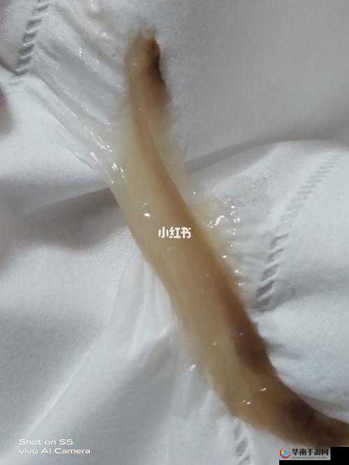 女生流出白白的东西怎么回事:探寻真相