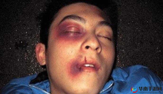 顶嘴被打肿脸:教育与惩罚的边界