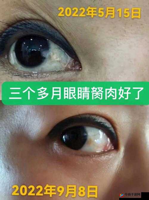 获得超级胬肉系统怎么办：这可如何是好