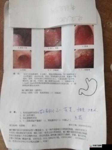 浜屾寚鎸栨礊鎵嬪娍鎶宸：其相关内容介绍