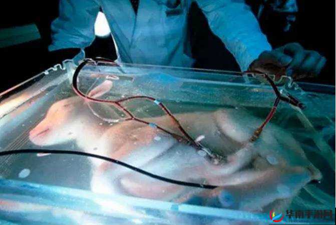 二人造孩子全程不盖被子-会得白血病吗之探究