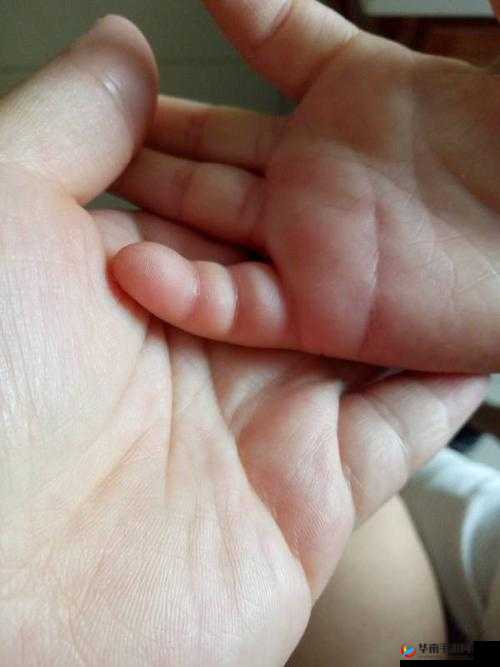 宝宝才三根手指就这么疼:原因何在