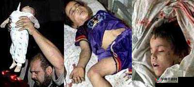 表妹红肿疼痛小缝不能合拢小孩状况堪忧