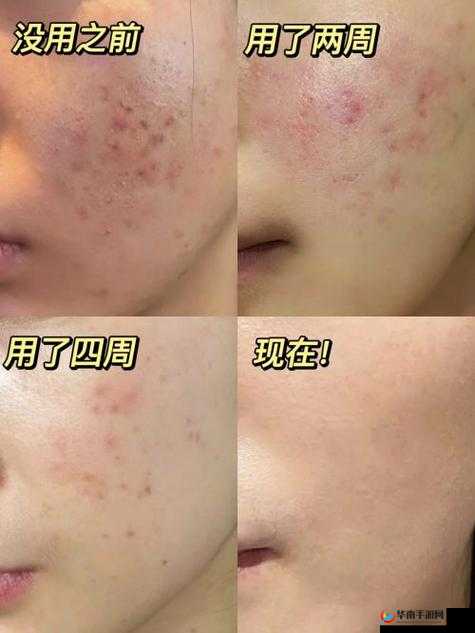 常天然精华液怎么样：使用效果及用户评价