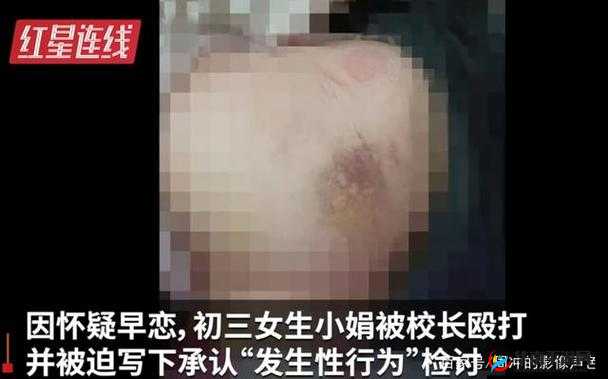 11 岁男孩想日逼了该如何应对