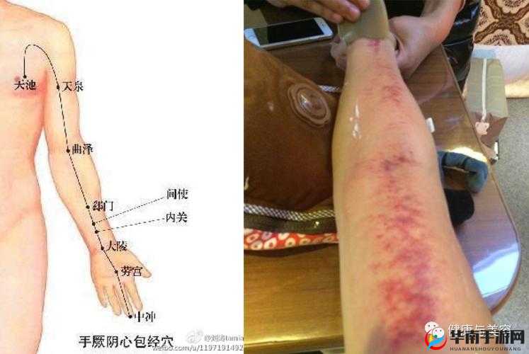 老中医给雨萱排阴毒：背后的神秘疗法