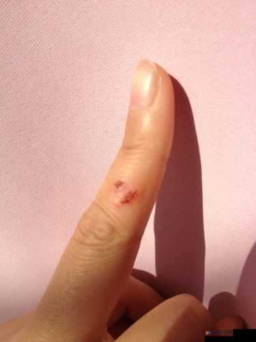 小白兔子被咬得通红惨状令人揪心