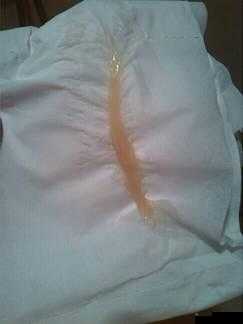 突然掉出来透明的一坨：这是什么东西