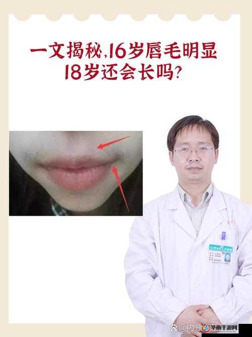 16 岁唇毛明显到 18 岁还会长吗：解惑时刻