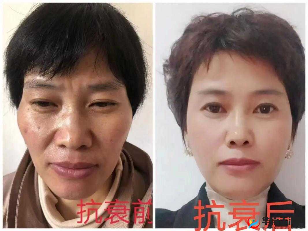 FREEZEFRAME 丰满老师抗衰奇迹揭秘