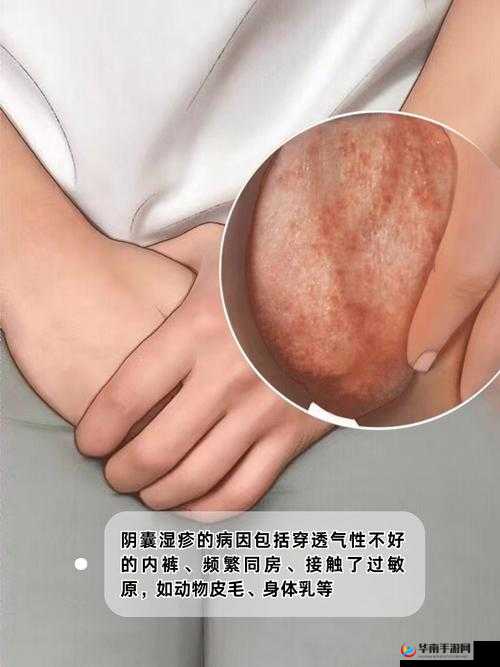 不小心看到了男生的睾丸怎么办：好尴尬啊