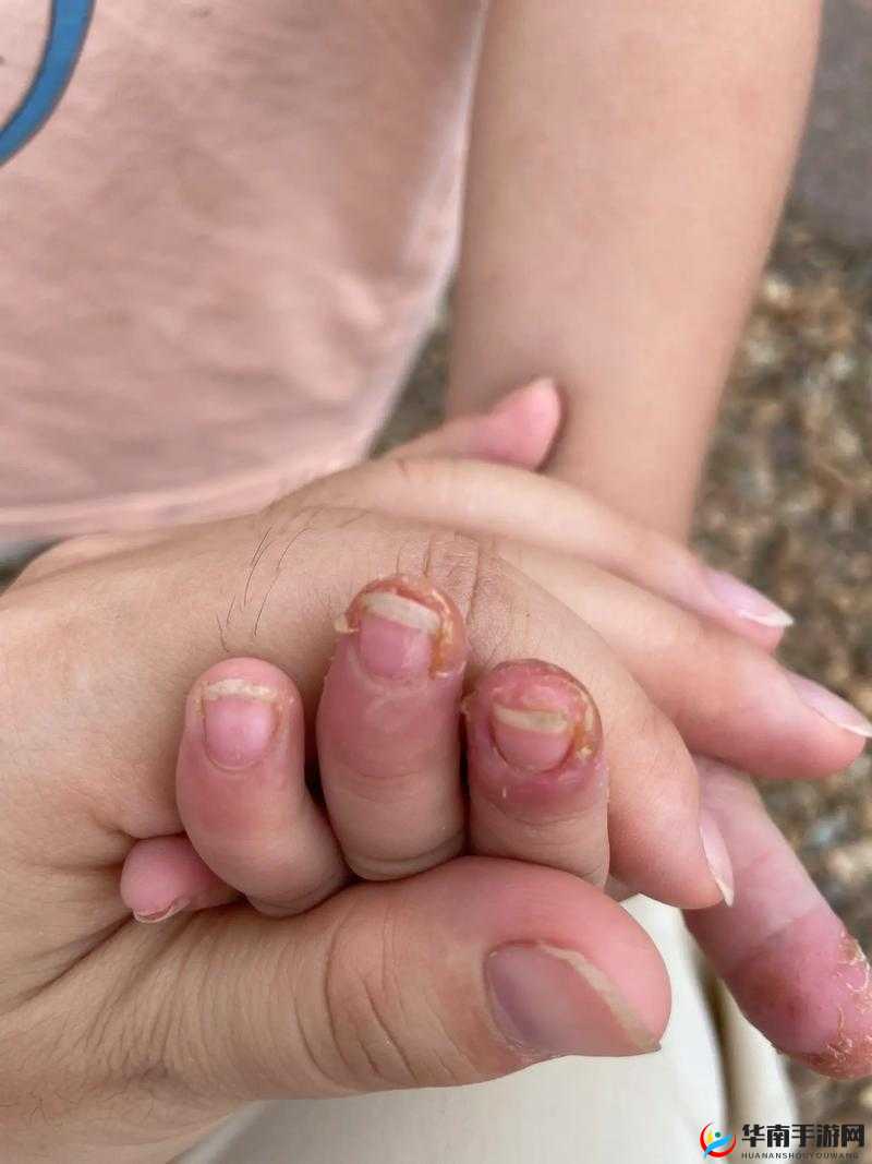 宝宝怎么才三根手指就痛：背后的原因令人深思