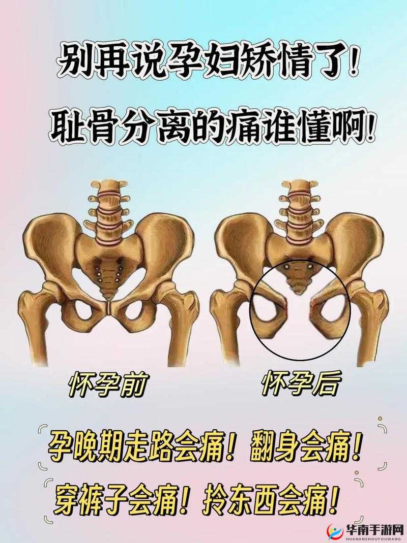 剧烈运动可能导致难产，孕妇需谨慎
