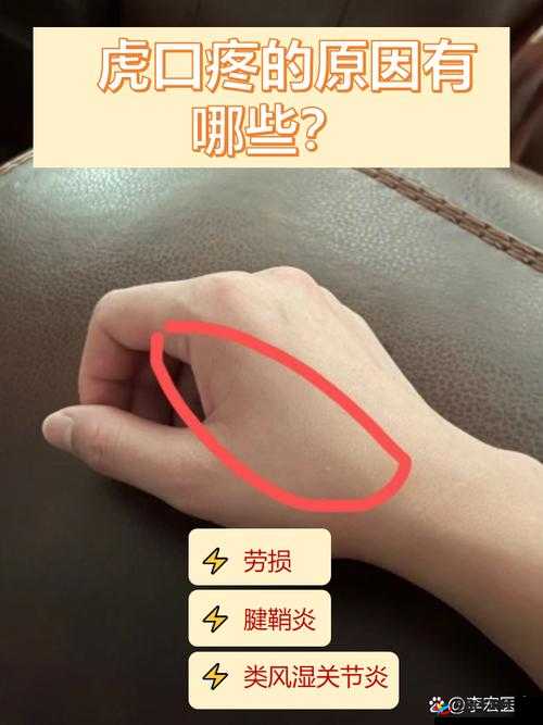 宝宝湿透嘴硬疼咋回事：原因探究