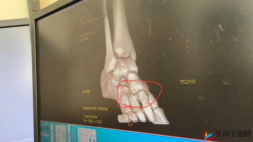 转过去趴好，撅高点，打完坐再去坐高脚凳