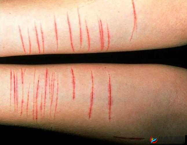 隐私惩罚：用刀划手臂