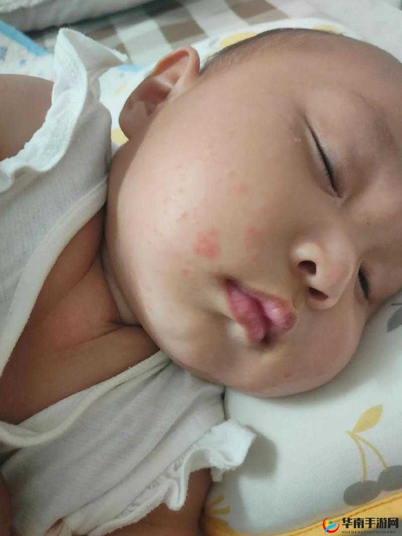 宝宝下面湿透嘴硬疼：如何应对？