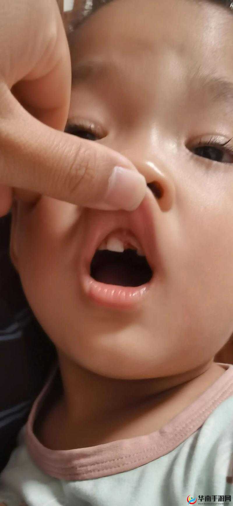 一小孩半夜吃坤风险（黄）：这可咋整