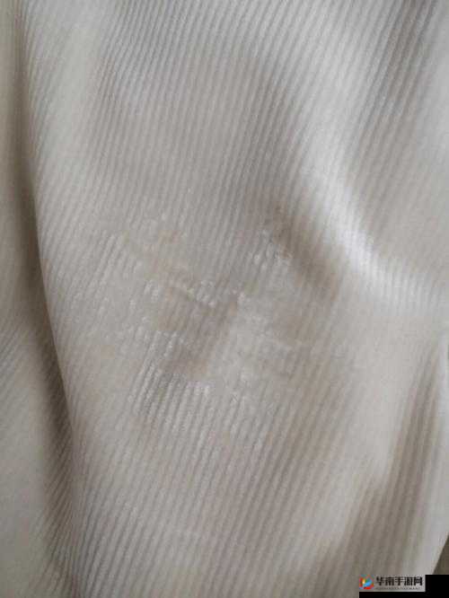 阴外面毛毛有白色是怎么回事-正常吗？