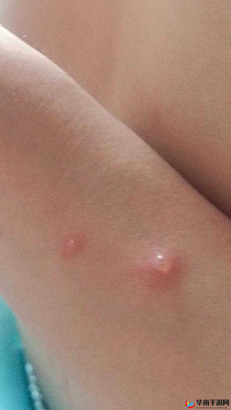 女生打扑克时腿迈开疼且痒