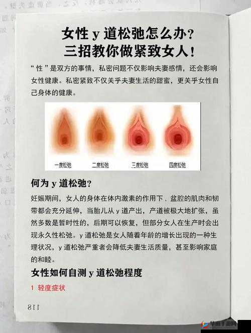 变松了还能变紧吗：探讨可能性