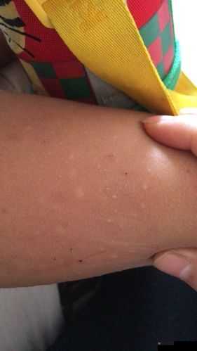 宝贝把腿张得大一点就不痛了：别害怕