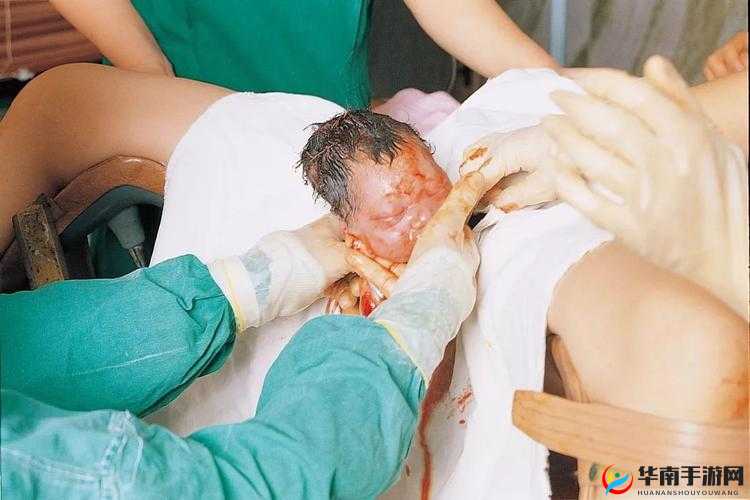 PRONXXXXHD分娩之过程详细解析与重要意义探讨