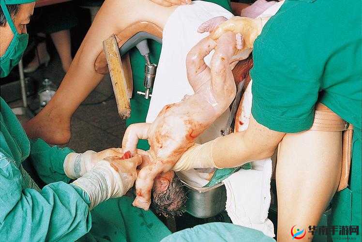 胎头湿漉漉从双腿间硬硬地挤出来的惊险分娩瞬间