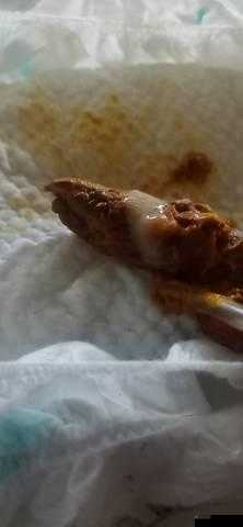 男生还没开始就有粘液是什么：这其中的原因及相关知识介绍