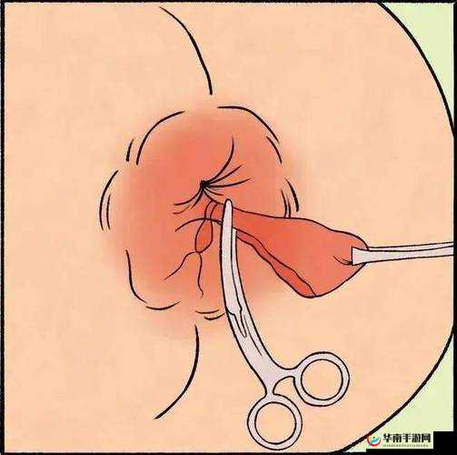 小受肛门塞着东西睡觉会怎样：可能出现的后果和影响