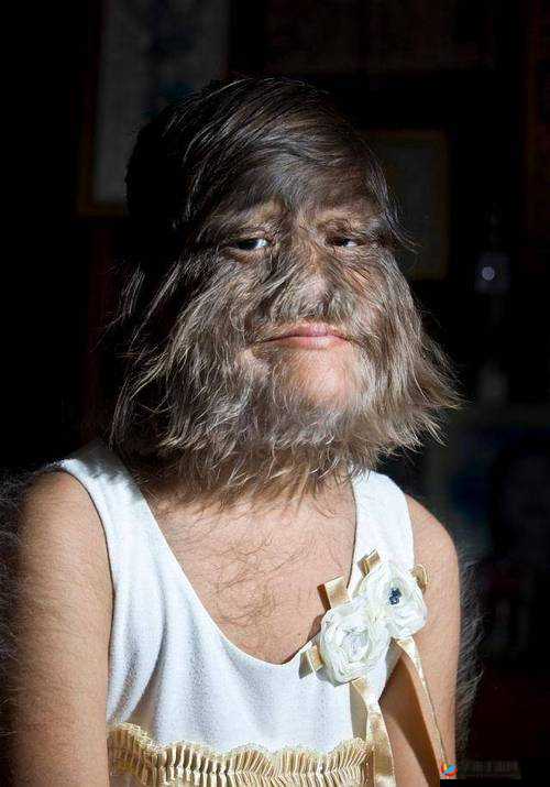 多毛老太婆：揭秘她的神秘世界