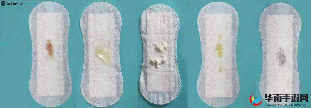 美女私密处流白带图片：揭示身体正常生理现象