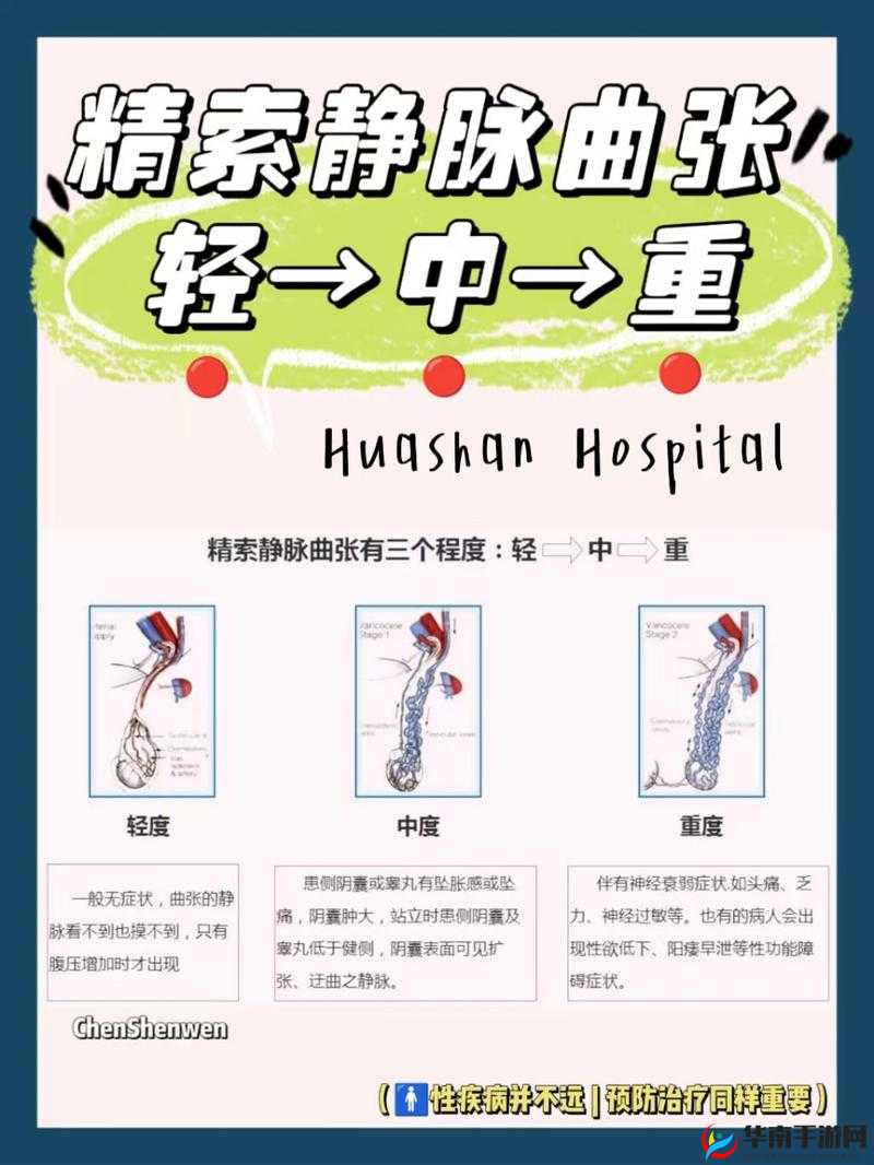 胡桃夹精索静脉曲张能治好吗：相关治疗方法与治愈可能性探讨