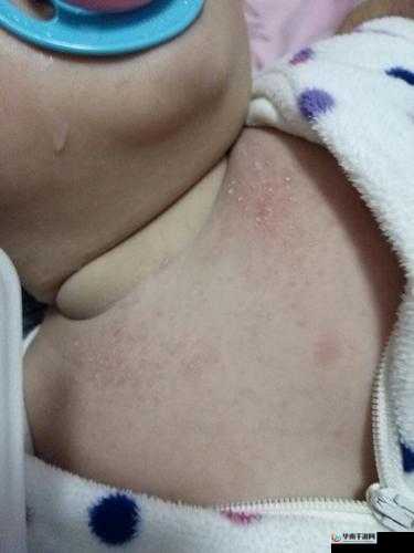 宝宝下面湿透了还嘴硬疼，这是为啥？