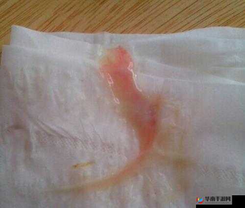 身体一动下面就会有水一样的分泌物，这是怎么回事呢