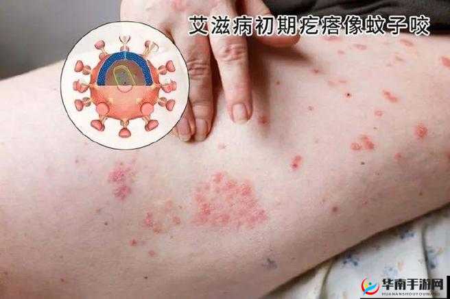 ：和女友第一次后，她的私密处变得又红又肿