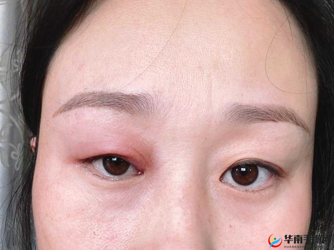 打开看看是不是肿了——究竟是否真的肿了呢