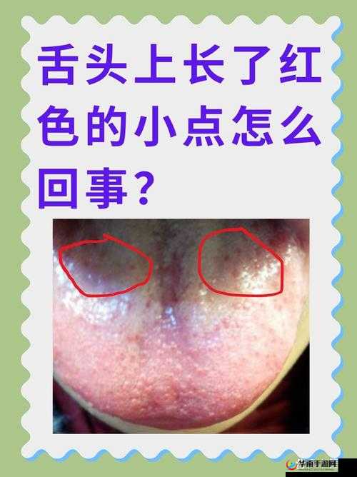 温热的舌头搅拌着疼怎么办：探寻有效的缓解之法