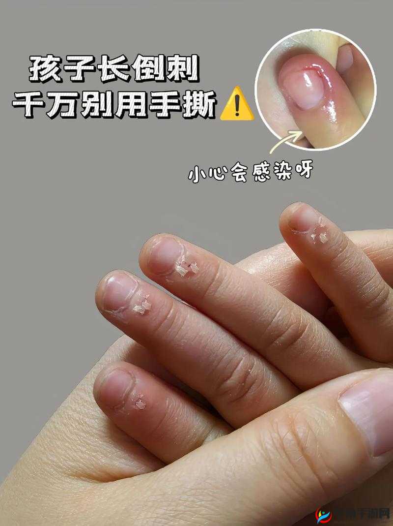 宝宝怎么才三根手指就痛：探寻其中缘由及应对方法