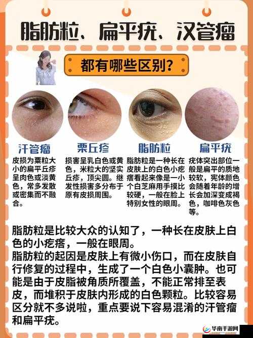 深入剖析 P31 和 P32 的区别究竟体现在哪些方面