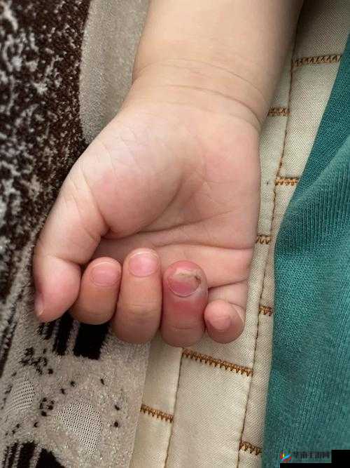 宝宝怎么才三根手指就痛：探寻其中原因及应对方法