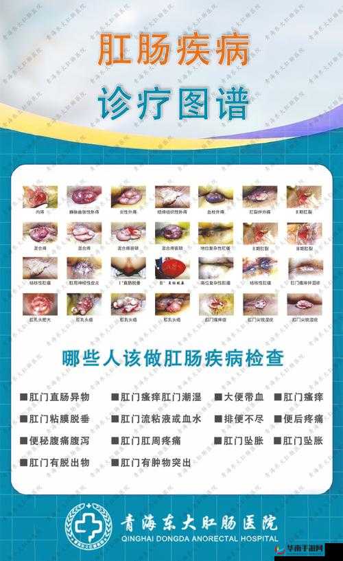 肛门息肉是什么?