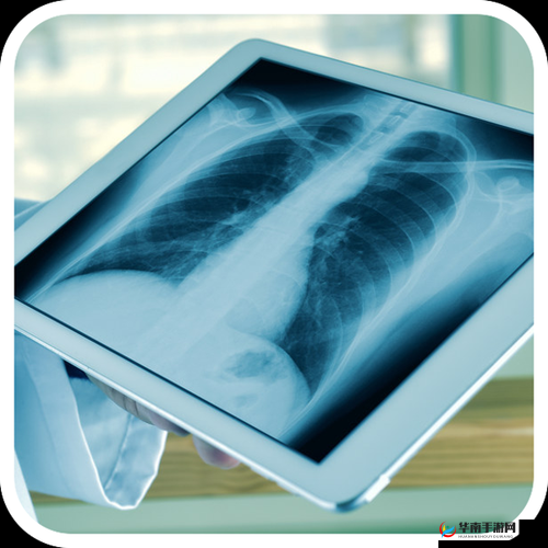 100%胸片曝光率免费：为民众健康带来全面保障