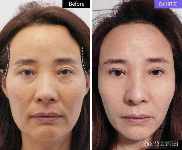 欧美人嘴巴更大还是更小：探究其面部特征的差异与成因