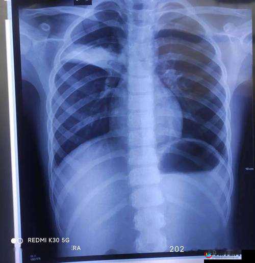 胸片 100%曝光公愤怒事件引发广泛关注与热议