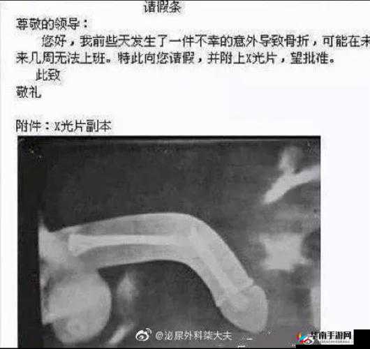 男人行房时勃不起，如何是好？