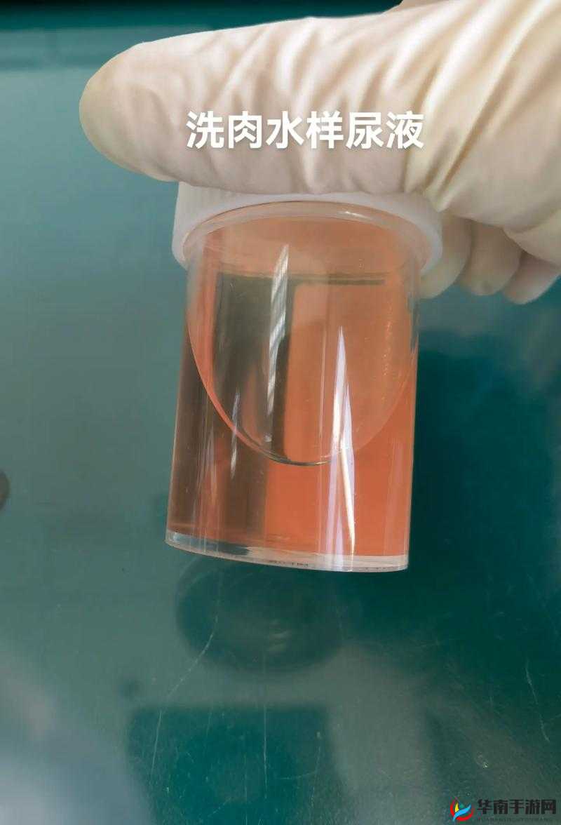 尿在肚子里不能流出来肉:一段令人费解的奇异状况描述