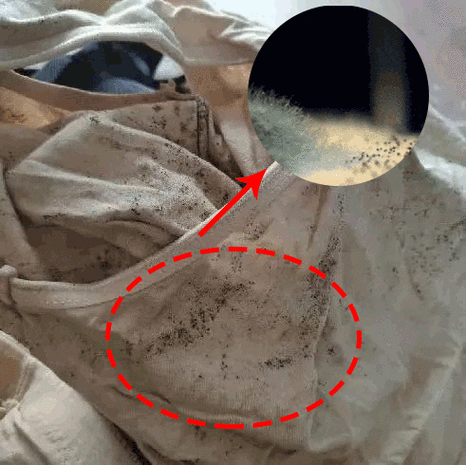 男性尿道口流脓且内裤上有黄黄分泌物，这是咋回事